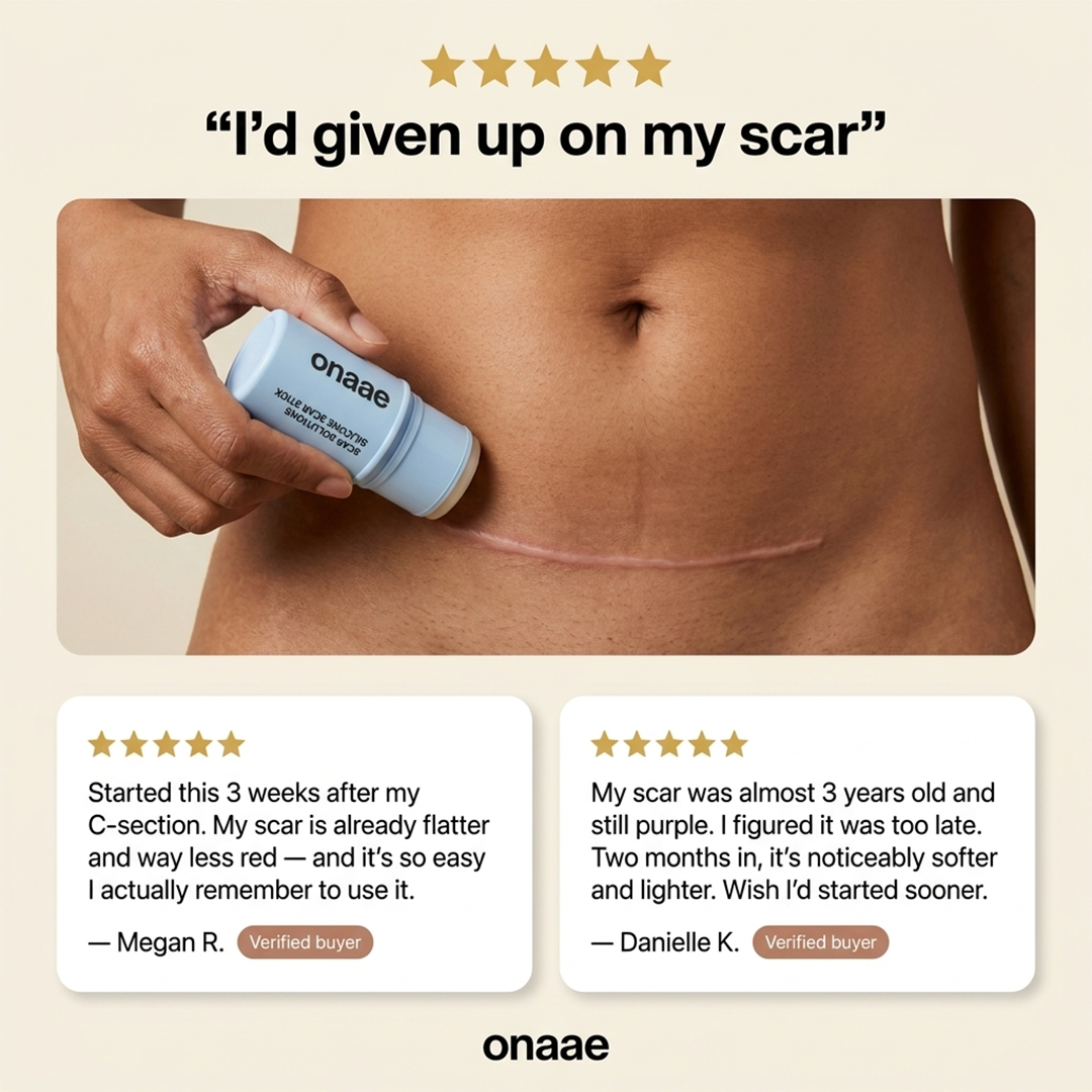 C-Section Scar Recovery Stick™