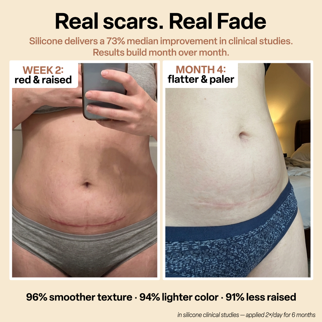 C-Section Scar Recovery Stick™