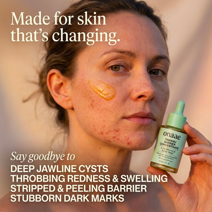 Hormonal Acne Defense Concentrate™