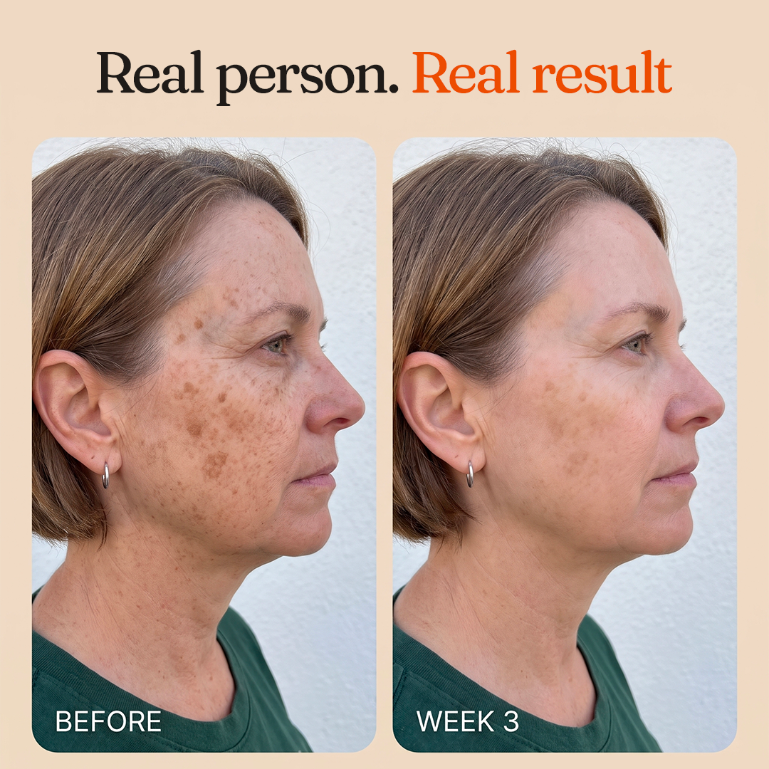 Astaxanthin Age Reverse Cream