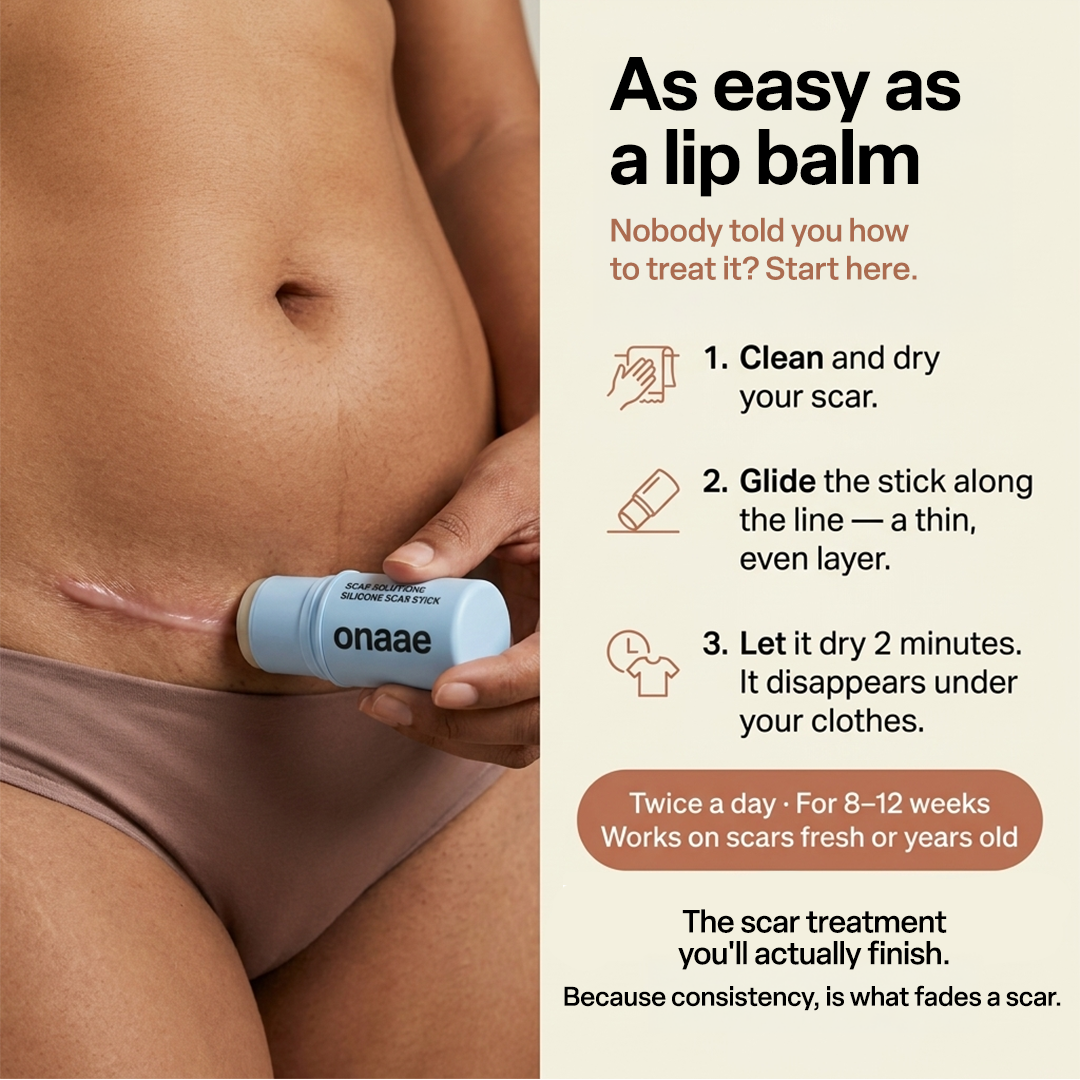 C-Section Scar Recovery Stick™
