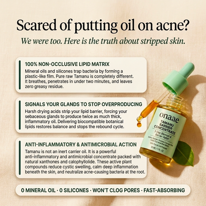 Hormonal Acne Defense Concentrate™